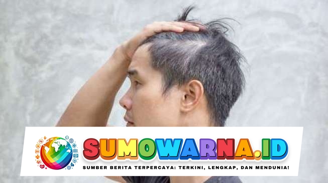 Cara Ampuh Mengatasi Rambut Beruban di Usia Muda